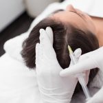 Mésothérapie par injection pour traiter une pathologie du cuir chevelu en clinique médicale